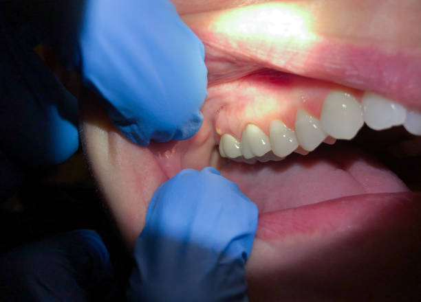 Best 24-Hour Emergency Dentist in Mount Gilead, NC